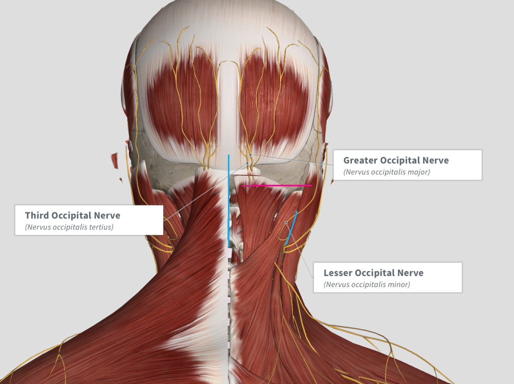 incisions for decompression of the occipital nerves