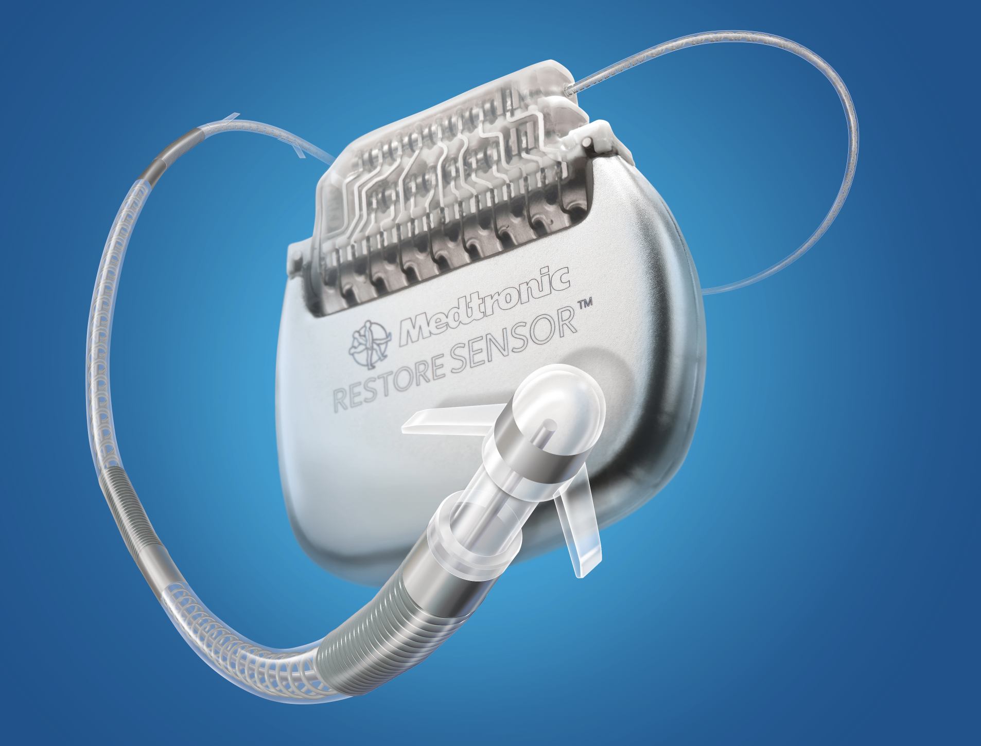 occipital nerve stimulator