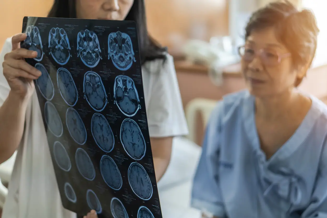 Rethinking Headache Diagnosis The Limits of Symptom-Based Classification