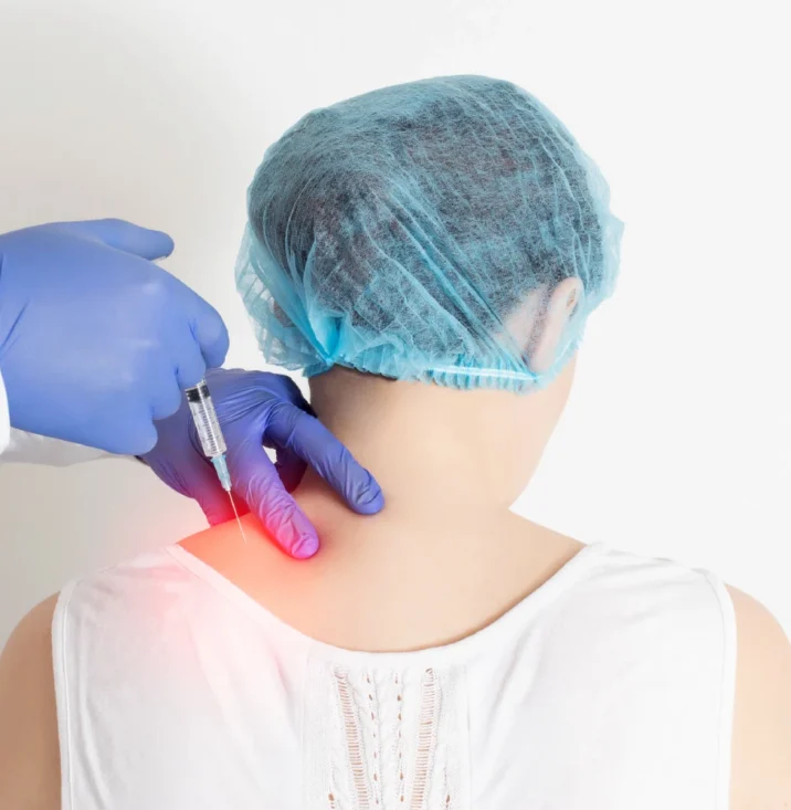 Doctor for Occipital Neuralgia