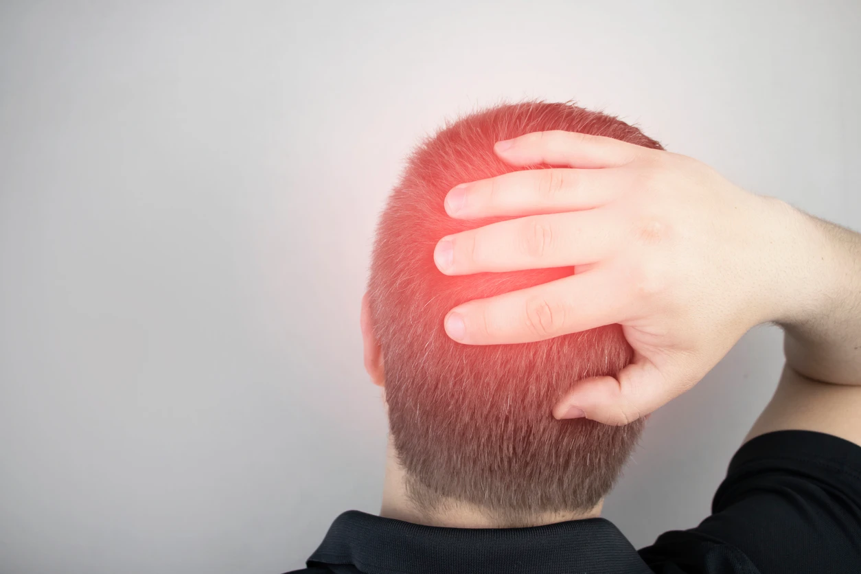 Occipital neuralgia