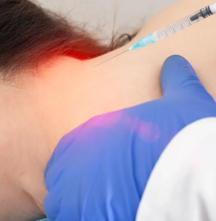 Occipital neuralgia headache