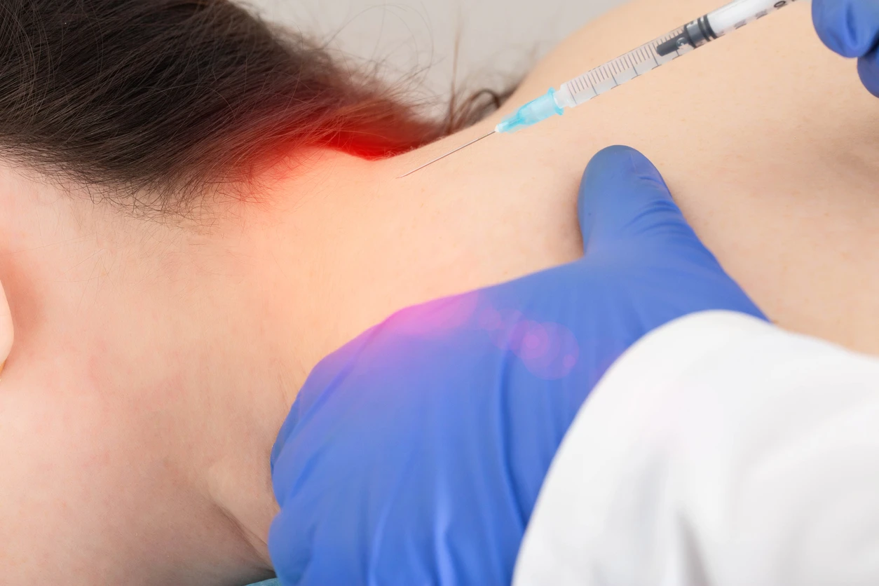Occipital neuralgia headache